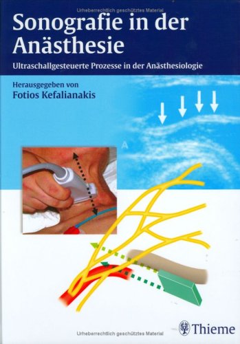 Sonografie in der Anästhesie ultraschallgesteuerte Prozesse in der Anästhesiologie ; 2 Tabellen