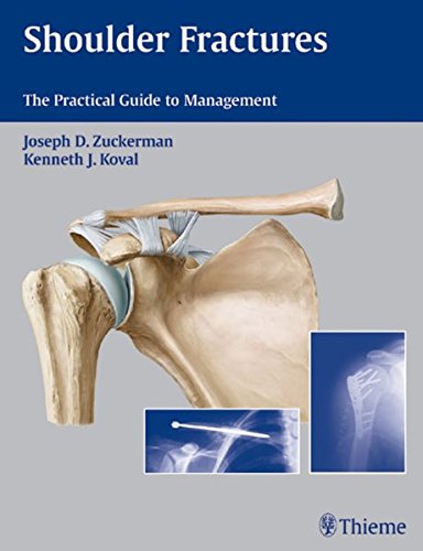 Shoulder fractures : the practical guide to management