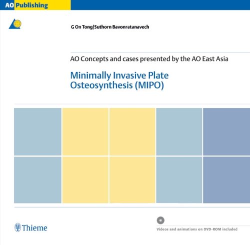 AO Manual of Fracture Managrment