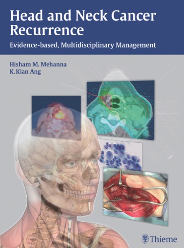 Head and Neck Cancer Recurrence