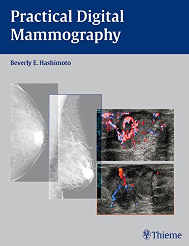 Practical Digital Mammography