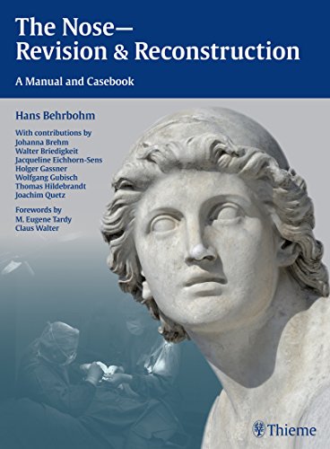 The nose-revision & reconstruction : a manual and casebook