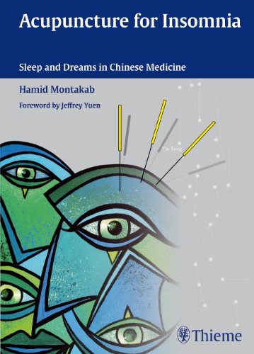 Acupuncture for Insomnia