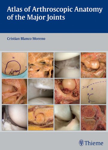 Atlas of Arthroscopic Anatomy of the Major Joints