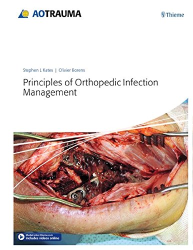 Principles of orthopedic infection management.