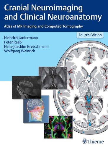 Cranial Neuroimaging and Clinical Neuroanatomy