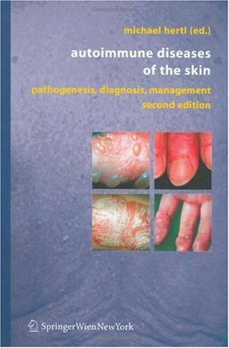 Autoimmune Diseases of the Skin: Pathogenesis, Diagnosis, Management