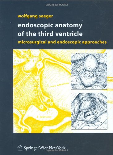 Endoscopic Anatomy of the Third Ventricle