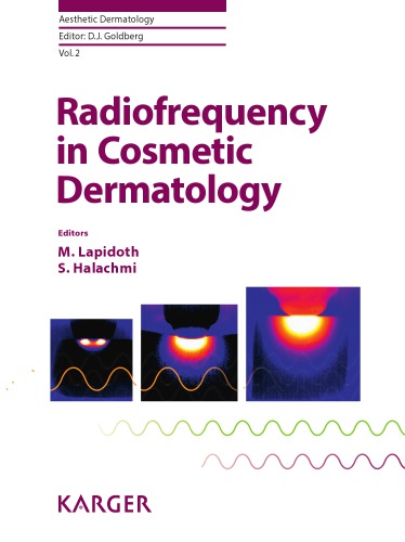 Radiofrequency in cosmetic dermatology