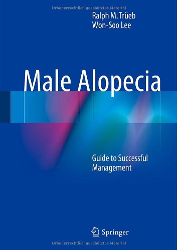 Male Alopecia