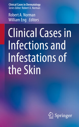 Clinical cases in infections and infestations of the skin