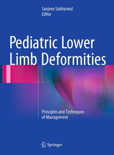 Pediatric Lower Limb Deformities Principles and Techniques of Management