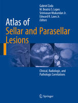 Atlas of Sellar and Parasellar Lesions : Clinical, Radiologic, and Pathologic Correlations