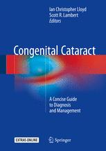 Congenital cataract : a concise guide to diagnosis and management