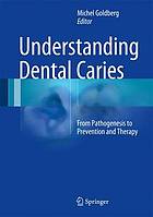 Understanding Dental Caries