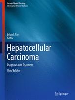 Hepatocellular Carcinoma Diagnosis and Treatment