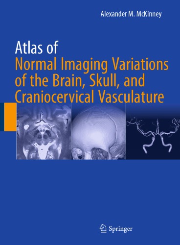 Atlas of Normal Imaging Variations of the Brain, Skull, and Craniocervical Vasculature