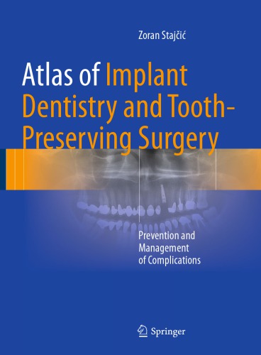 Atlas of Implant Dentistry and Tooth-Preserving Surgery Prevention and Management of Complications