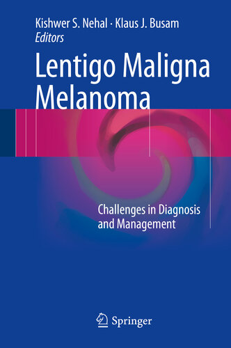 Lentigo Maligna Melanoma Challenges in Diagnosis and Management