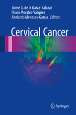 Cervical Cancer