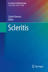 Scleritis