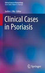 Clinical cases in psoriasis