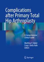 Complications after Primary Total Hip Arthroplasty A Comprehensive Clinical Guide