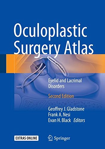 Oculoplastic Surgery Atlas