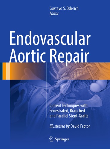 Endovascular Aortic Repair