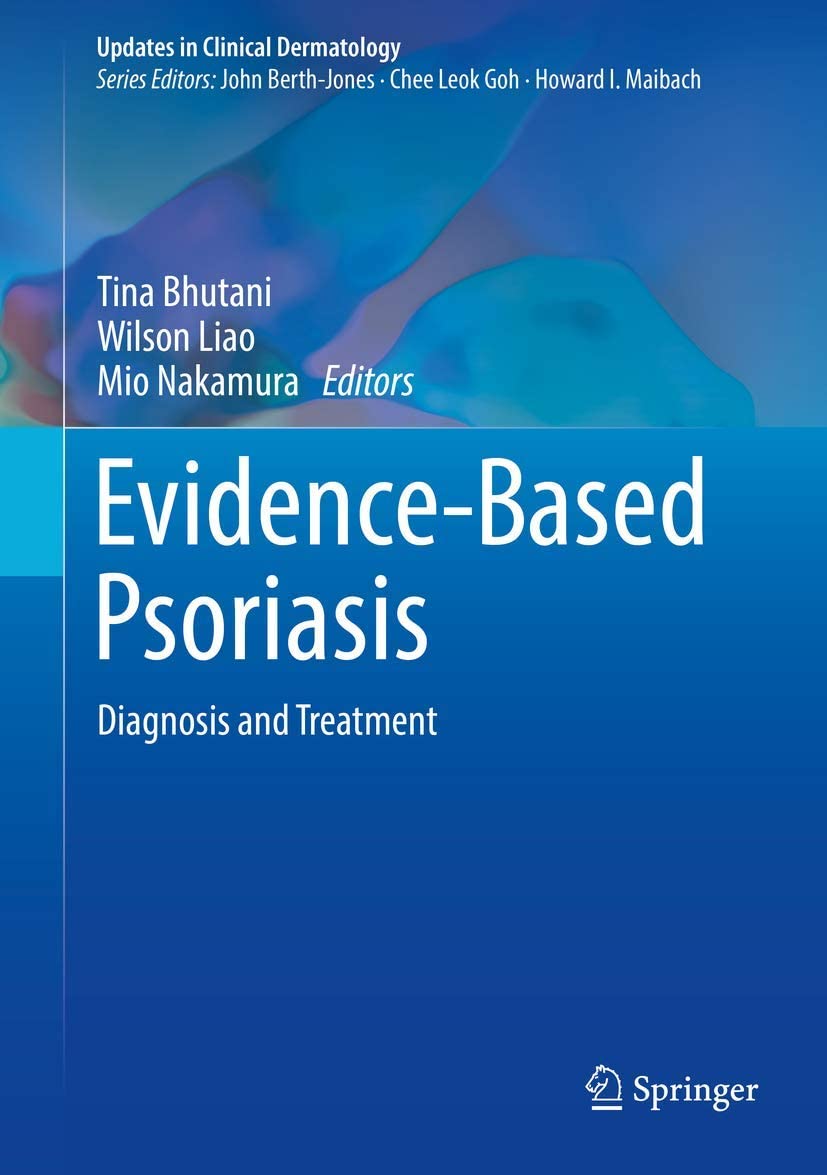 Evidence-based psoriasis : diagnosis and treatment