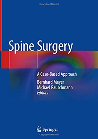 Spine Surgery