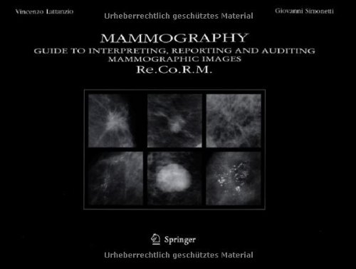 Mammography