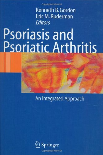 Psoriasis And Psoriatic Arthritis