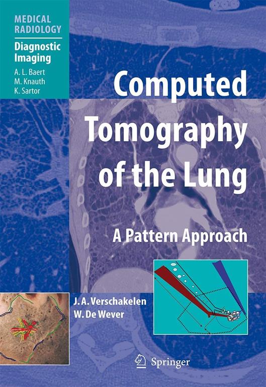 Computed Tomography of the Lung