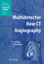 Multidetectorrow CT Angiography