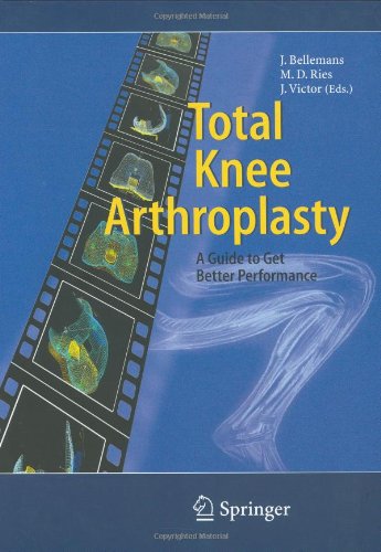 Total Knee Arthroplasty