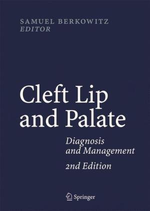 Cleft Lip and Palate