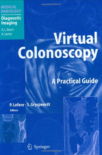 Virtual Colonoscopy