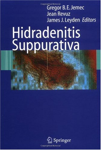 Hidradenitis Suppurativa