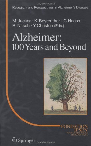 Alzheimer