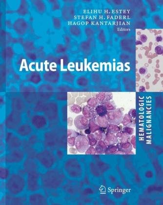 Hematologic Malignancies