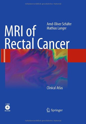 MRI of Rectal Cancer