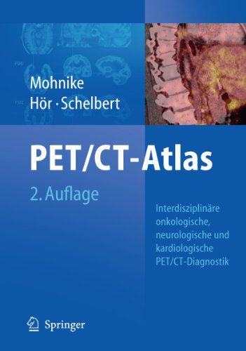 Oncologic and Cardiologic Pet/CT-Diagnosis