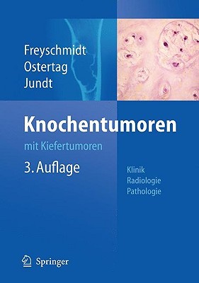 Knochentumoren Mit Kiefertumoren