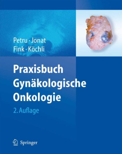 Praxisbuch Gynäkologische Onkologie (German Edition)