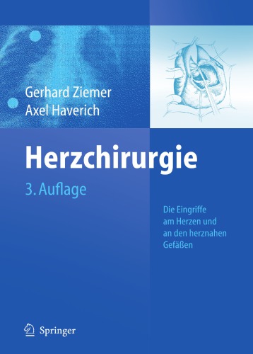 Herzchirurgie : Die Eingriffe am Herzen und den herznahen Gefäßen