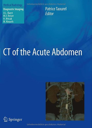 CT of the Acute Abdomen