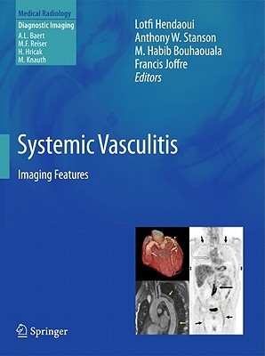 Systemic Vasculitis