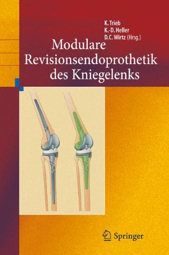 Revisionsendoprothetik des Kniegelenks