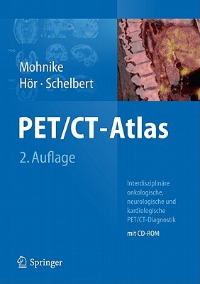 PET/CT-Atlas